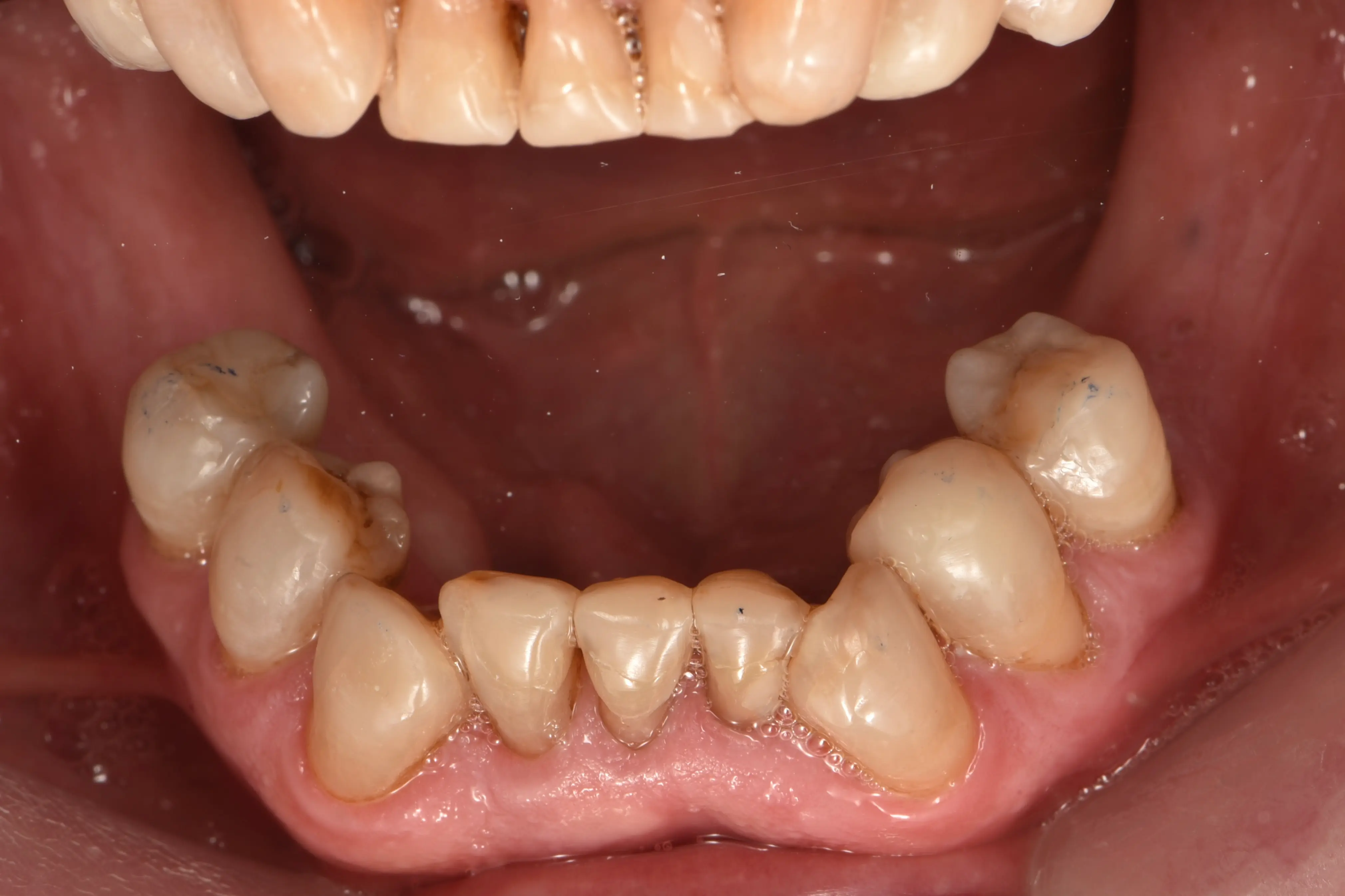 Clinical 3