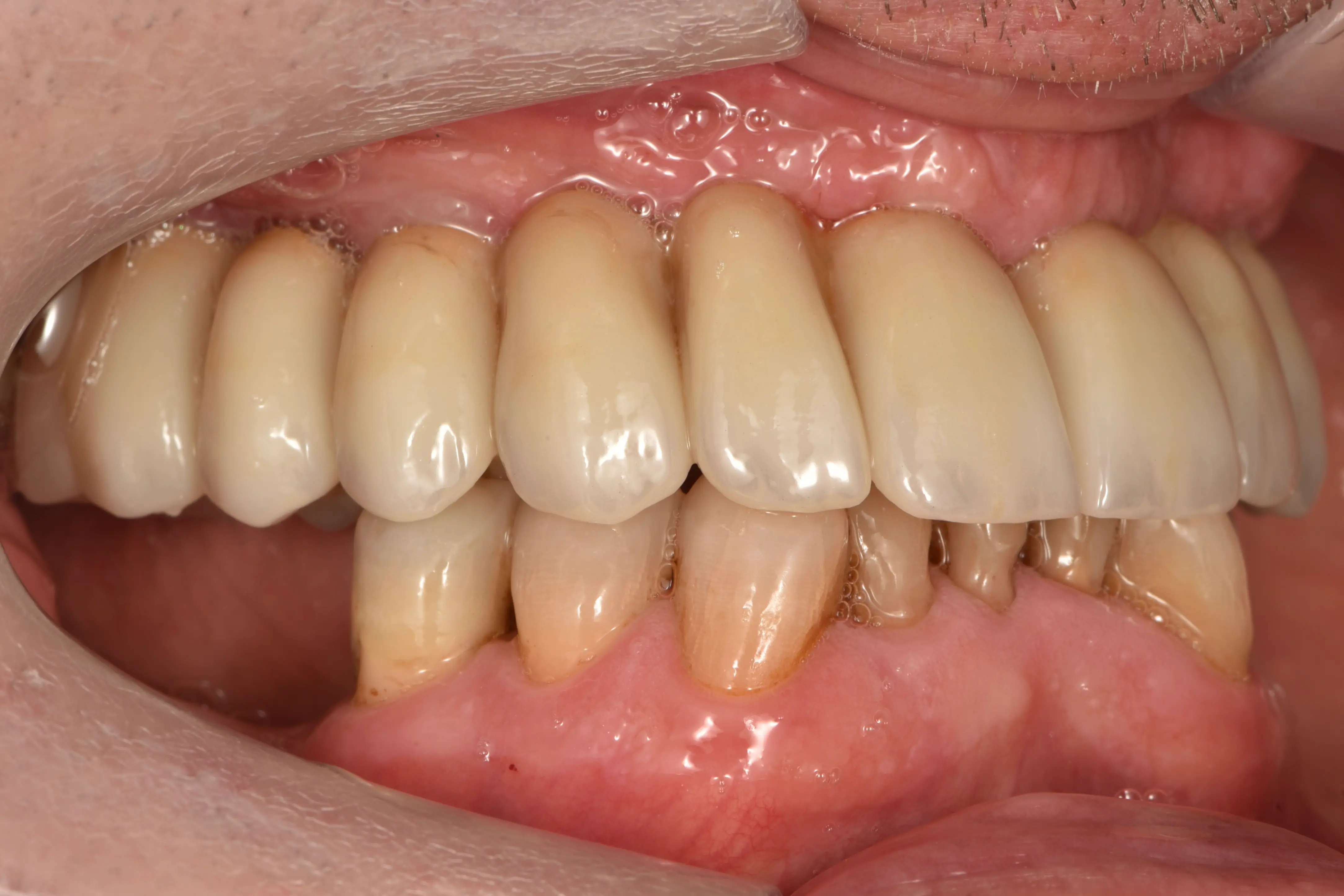 Clinical 4
