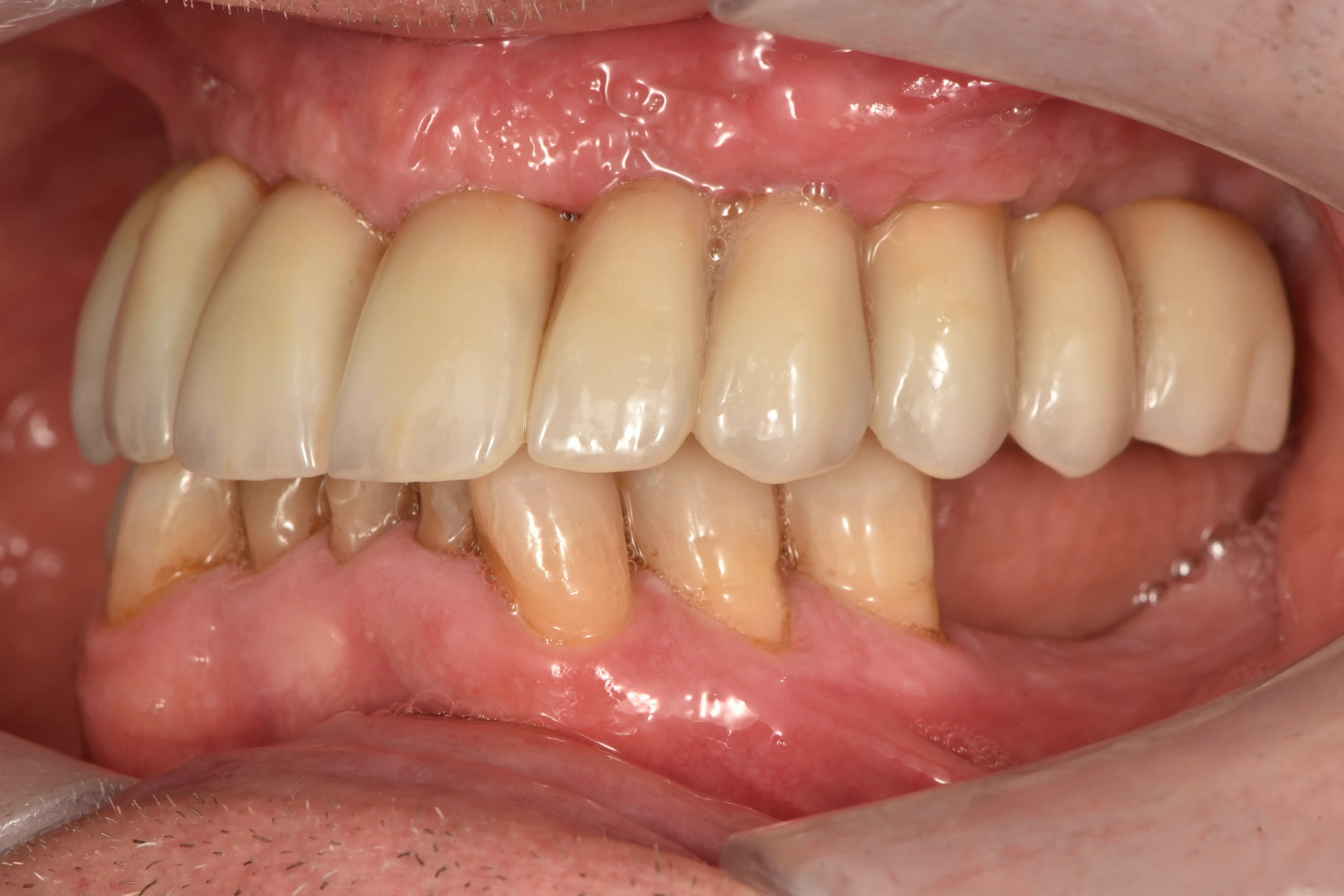 Clinical 6