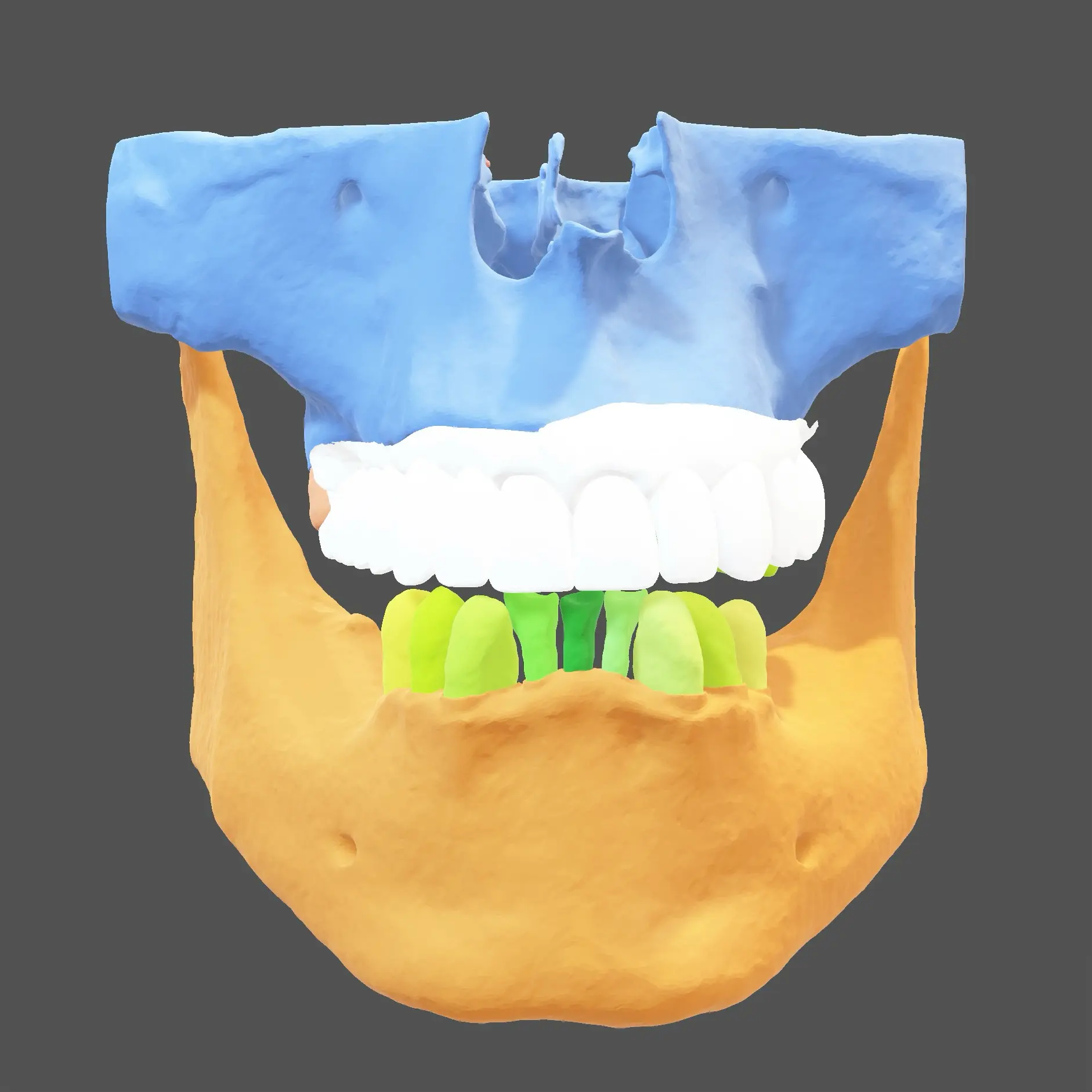 Pre-Op Step 2