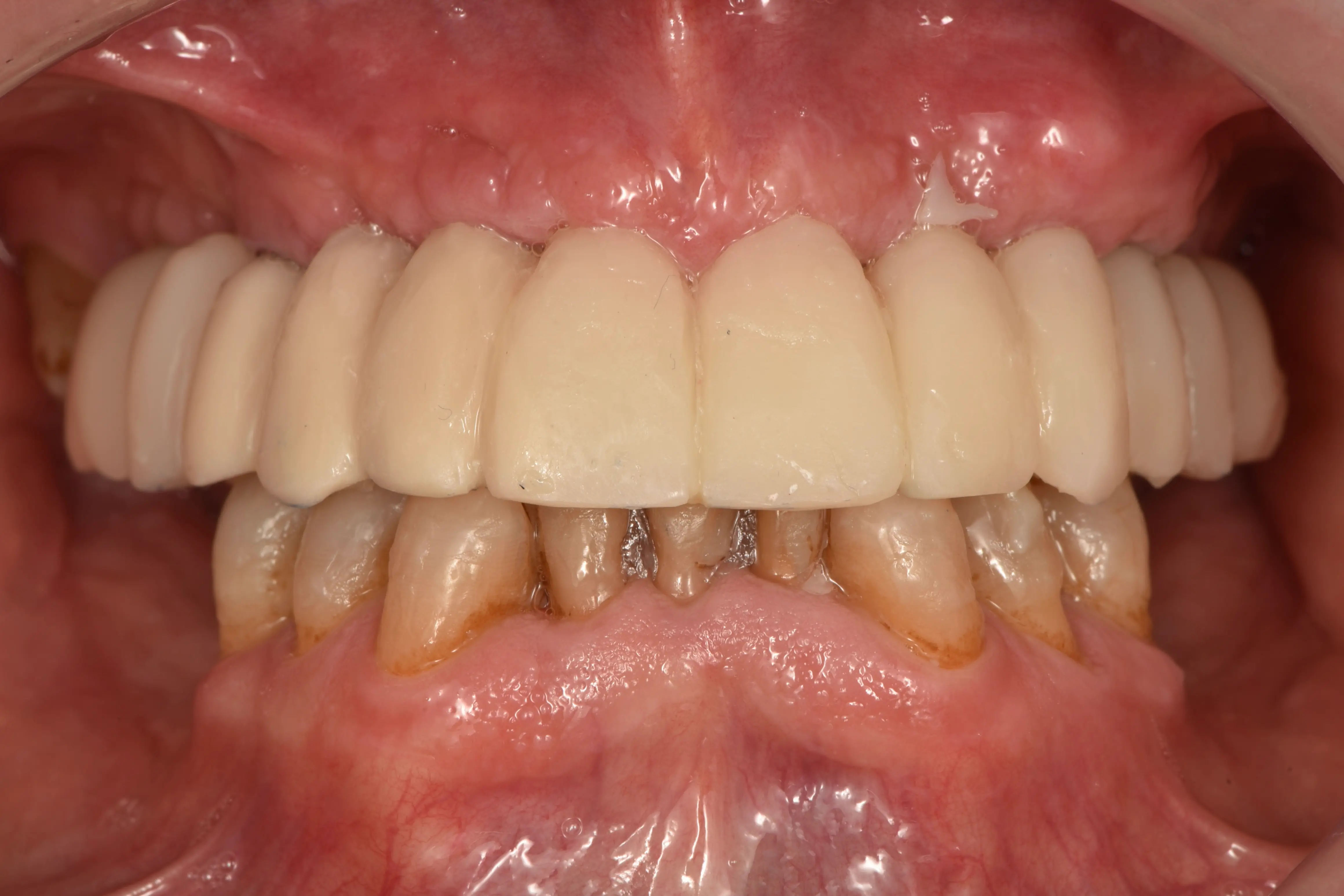App 3 Photo